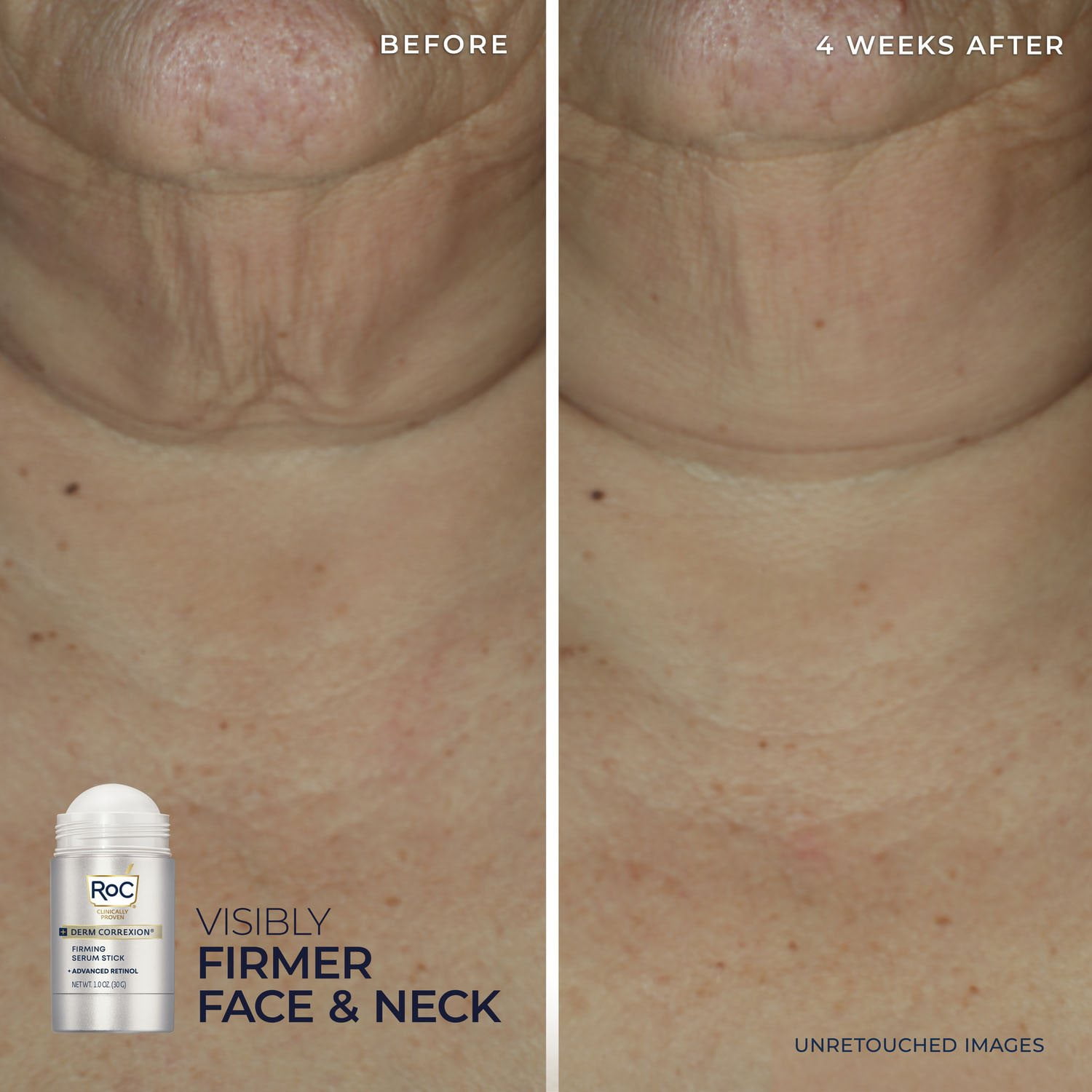 RoC Derm Correxion Firming Serum Stick and Contour Cream Kit - Image 4