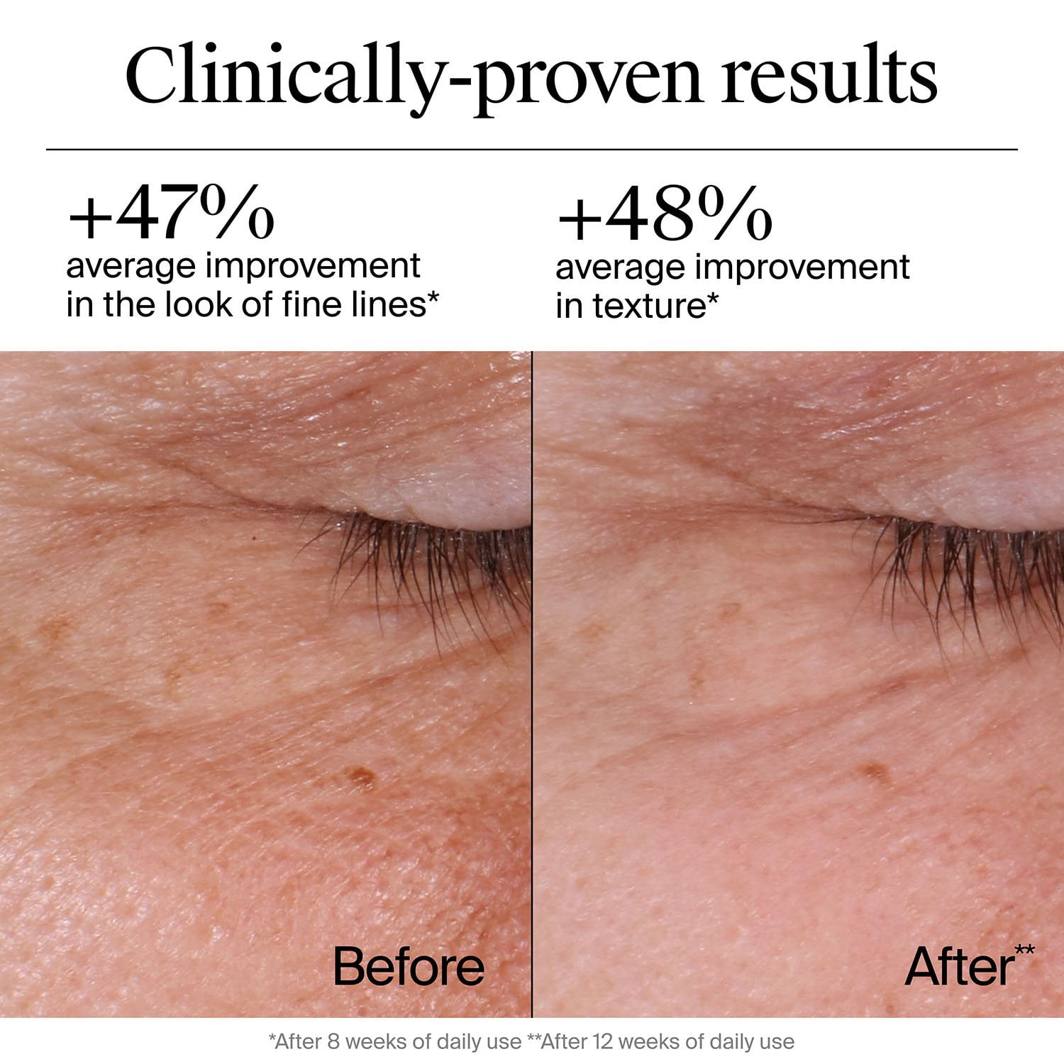 Neutrogena Rapid Wrinkle Repair Retinol Cream, 1.7 oz., 2 pk. - Image 4