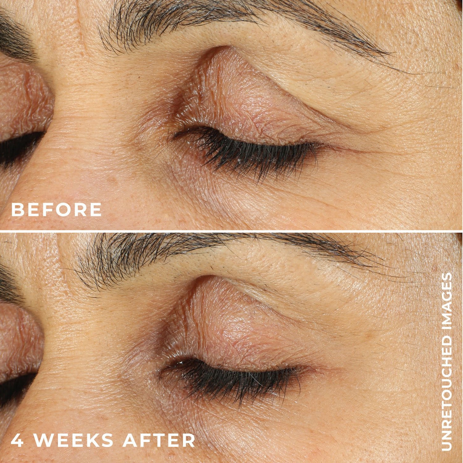 RoC Retinol Correxion Line Smoothing Eye Cream, 0.5 fl. oz., 2 pk. - Image 4